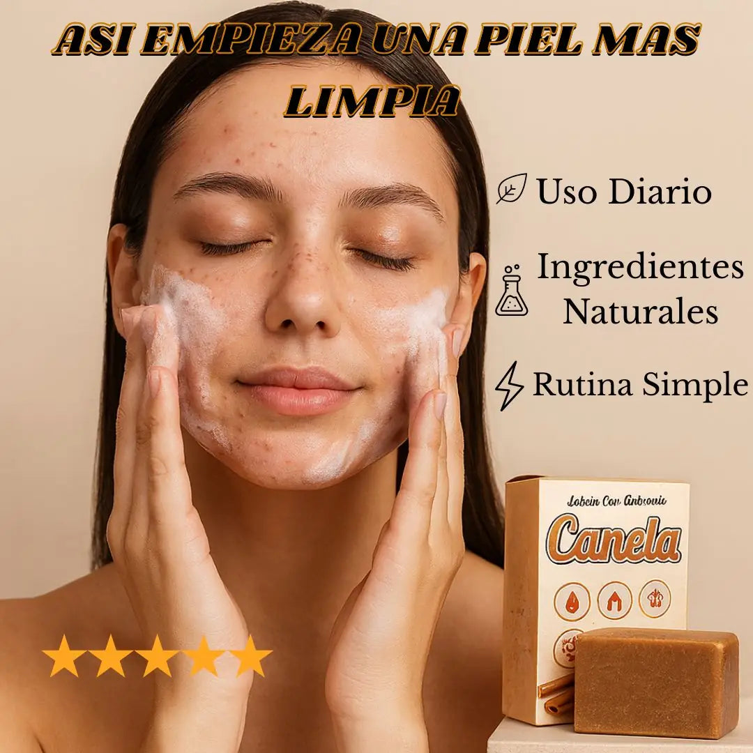 3 Jabones Canela Elimina Imperfecciones + 1 De Regalo